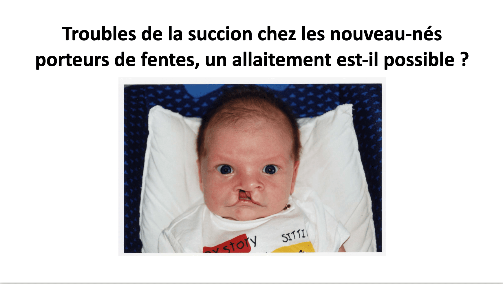 Dyskate - Allaitement et Fentes